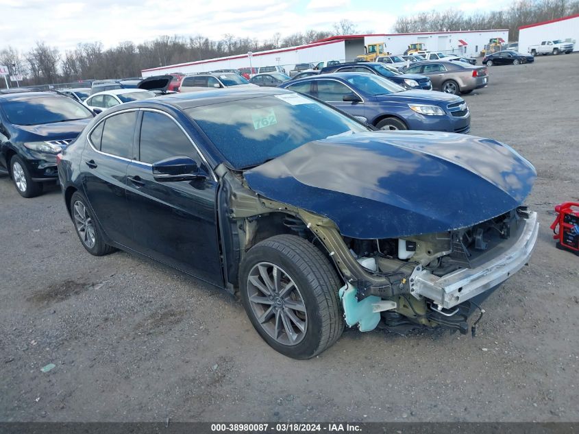 2020 ACURA TLX TECH PACKAGE