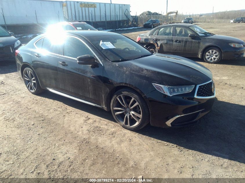 2020 ACURA TLX TECH PACKAGE