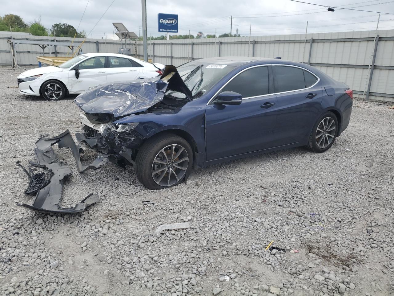 2015 ACURA TLX TECH