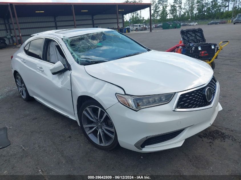 2020 ACURA TLX TECH PACKAGE